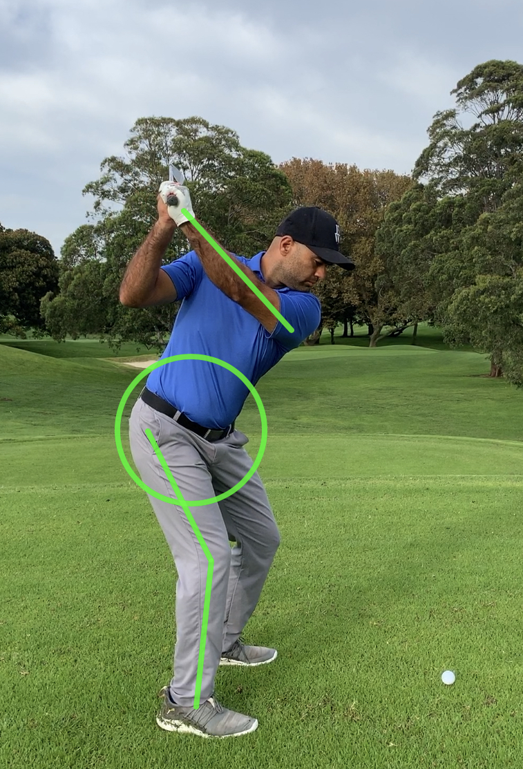 Golf Swing Fault Right leg straightening Lilyfield Physiotherapy