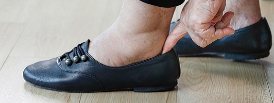 What shoe to wear when you have swollen feet?
