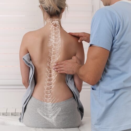 scoliosis-physio-x-ray Woman during a scoliosis physio appointment with her spine demonstrating curve